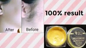 Wiki  Hair remover  cream